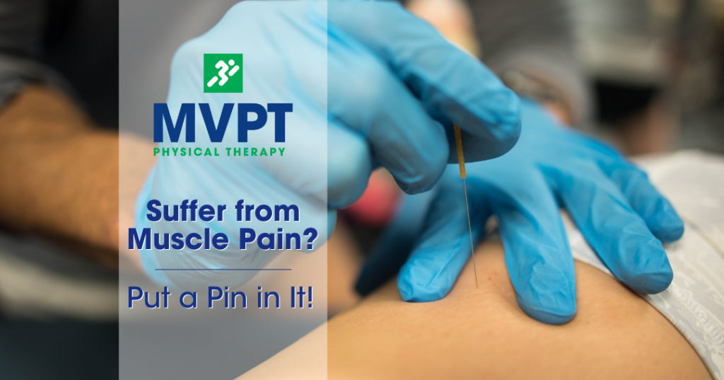 Suffer from Muscle Pain? Put a Pin in It!