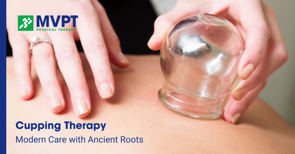 Cupping Therapy: Modern Care with Ancient Roots