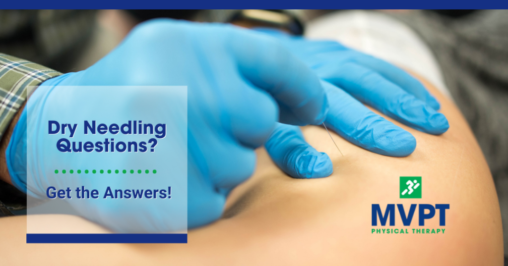 Dry needling questions? We've got the answers!