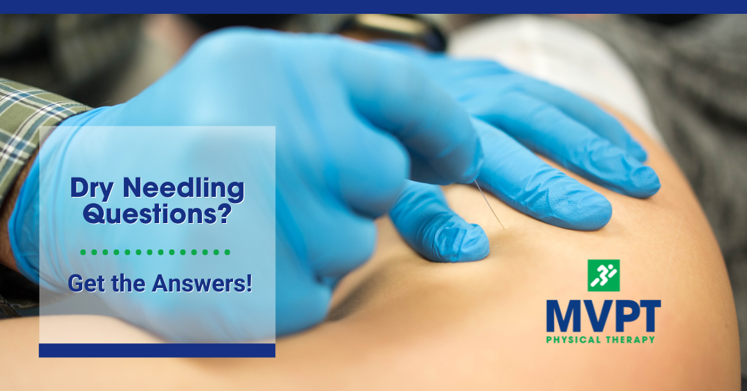 Get Answers to All Your Dry Needling Questions
